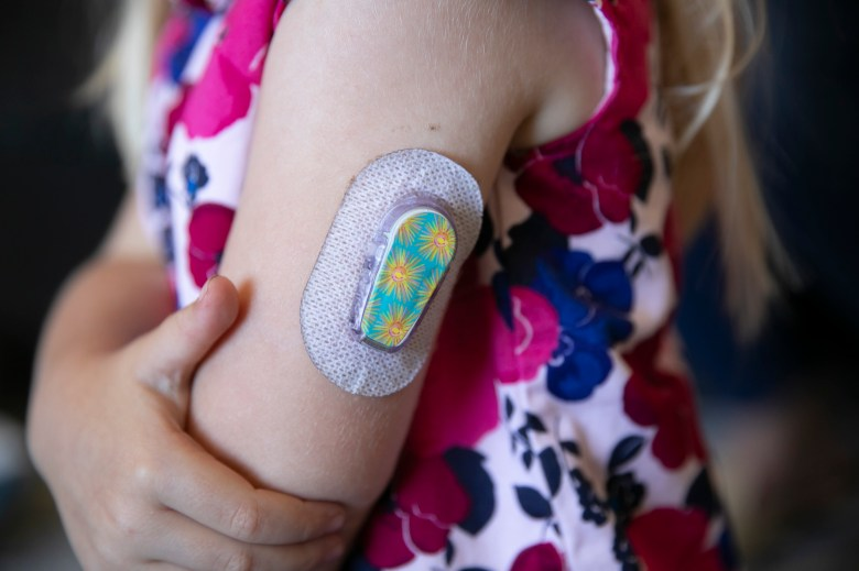 Eleanor, 4, shows off her insulin pod which continuously gives her insulin throughout the day to help manage her type 1 diabetes and is controlled on a remote by her parents. Photo by Anne Wernikoff, CalMatters